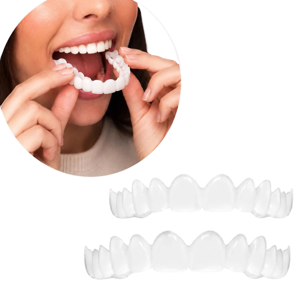 Cosmetic dental veneers